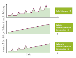 Multiple angiomyolipome der niere in unklaren fällen kann die diagnose molekulargenetisch gesichert werden. Multiple Sklerose Ms Verlauf Schub Lebenserwartung Therapie Pflege De