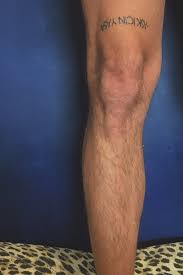 In the case of a quadriceps injury, there is a strain (which is a small tear of the muscle). Turkish In Tattoos Search In 1 3m Tattoos Now Tattoodo