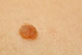 Pin On Natural Remedies