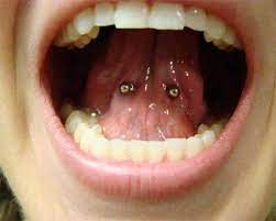 Tongue Web Piercing Web Piercing Tongue Piercing Jewelry