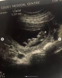 Adakah anda mempuyai ramai anak perempuan tetapi tiada anak lelaki? Dah Setahun Usia Isabella Depp Nourul Kongsi Cara Tunaikan Hasrat Suami Nak Hamil Anak Perempuan Pa Ma