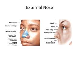 Clinical anatomy of the nose, nasal cavity and paranasal sinuses. External Nose Anatomy Anatomy Drawing Diagram