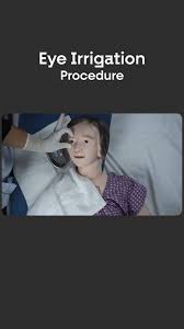 Image result for Eye Irrigation