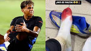 Lamine Yamal muestra la fuerte herida en su pie tras el Las Palmas vs  Barcelona - ClaroSports