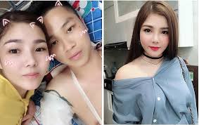 Bị tố sống ảo, vợ nạn nhân bị chém phải cắt chân lên tiếng