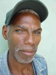 This experience is not totally different from the reaction of certain nigerian parents that gave birth to a blonde hair/blue eyed. Discover Why Some Blacks Have Natural Blue Eyes Afroculture Net