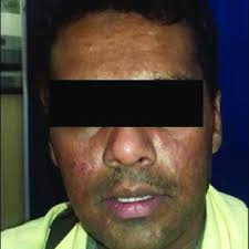 Seethalakshmi VELLAISAMY