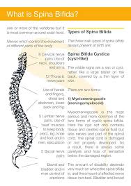 What Is Spina Bifida Spina Bifida Spinal Cord Spinal