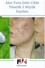 Aloe Veranin Cilde Faydalari Nelerdir Faydalari Nelerdir 2020 Cilt Bakimi Tuyolari Aloe Cil