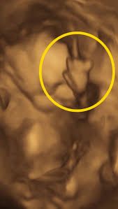 Mom's shock as baby flips her off in womb: 'We're in trouble'