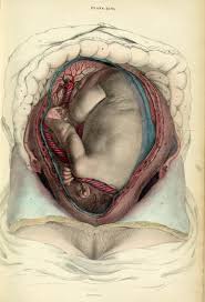 Gravid Uterus With Fetus In Situ From System Of Anatomical Plates By John Lizars 1825 Www Facebook Com Human Anatomy Art Anatomy Art Medical Drawings