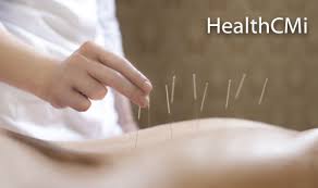 Texas Acupuncture Cae Requirements Healthcmi