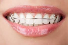 Are you a suitable candidate for orthodontic treatment? - Complete Dental
