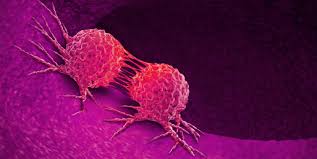 The person's breathing becomes irregular and may become noisy. What Are The Cancer Signs Symptoms Tests And Treatments Everyday Health