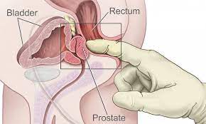 (image point fr / shutterstock) Orgasmus Bei Prostata Untersuchung Homo Hasser Schiesst Auf Urologen Queer De