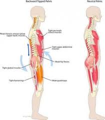 Pin On Back Pain