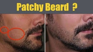 How to get fuller facial hair 1. 14 Ways To Make Your Beard Grow Faster Get Rid Of Patchy Beard Natural Home Remedies Youtube