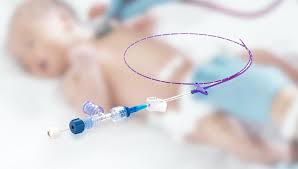 Image result for IV Access