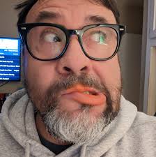 What are the recommended boost and turbo settings for MST 2.0?