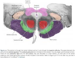 At the caudal part of the medulla these tracts cross over in the decussation of the pyramids obscuring the fissure at this point. Duke Neurosciences Lab 2 Spinal Cord Brainstem Surface And Sectional Anatomy
