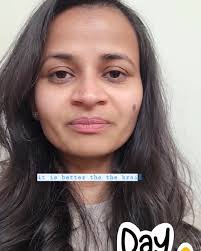 Day 3 of Vestibular Rehab Mantra, Start your Vestibular Rehab as early as  you can, even if you are highly symptomatic., Your Vestibular therapist  will give you strategies to tackle acute symptoms., # ...