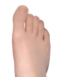 Body part located at the end of the leg; Toe Wikipedia