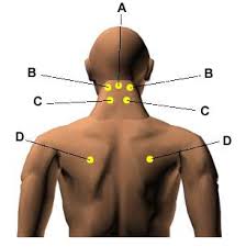 Les fonctions indications et applications cliniques des points d'acupuncture, les descriptions des grands ensembles de méridiens, des maladies et syndromes en mtc, mis à la disposition des. Points D Acupression Pour Soulager Et Guerir Les 10 Douleurs Les Plus Courantes By Shopvip Fr Medium