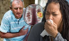 This is the most common type of lung cancer, accounting for approximately 85% of lung cancers. Lung Cancer Symptoms Signs Include Chest Pain And Coughing Blood Express Co Uk