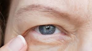 Image result for Centrostigma papillosum