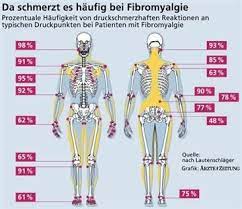 Typische Symptome Enttarnen Die Fibromyalgie Fibromyalgie Fibromyalgie Symptome Fibromyalgie Ernahrung