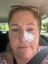 Is chemotherapy effective in stage 4 ?