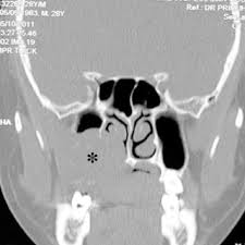 At johns hopkins medicine, your health and safety are our very highest priorities. A Najihah S Research Works Kuala Lumpur Sports Medicine Centre Kuala Lumpur And Other Places