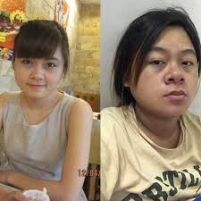 Dấu hiệu nhận biết có thai qua khuôn mặt, điều gì cần chú ý