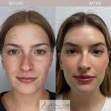 Launching Soon 😍 . . . . . #launch #theaestheticslab #thealab #tampa  #florida #holidaylaunch