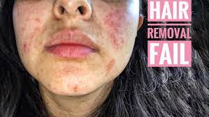 Spread in a thick, even layer over the area in which you want to remove facial hair. Can You Use Nair On Your Face Epilator Authority