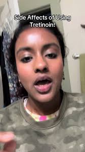 Trenton Owen Before and After Pictures