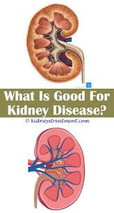 Kidney Disease Children Kidney Disease Recipes Kidney Disease Kidney Disease Diet