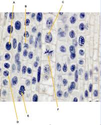 Mitosis is a type of cell division in which one cell (the mother) divides to produce two new cells (the daughters) that are genetically identical to itself. Solved Hello This Is A Onion Root Under A Microscope I N Chegg Com