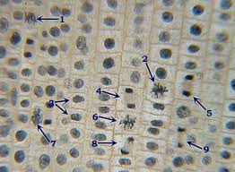 Prophase, metaphase, anaphase and telophase. 1 3 1 The Cell Cycle And Mitosis Siyavula Life Sciences Grade 10 Openstax Cnx
