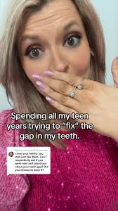 Replying to @mamakim727 i tried to fix it. Saw 14 specialist in 3 diffetent  states. Thr gap in my teeth cant be corrected without surgery & the surgery  comes with a risk of losing all ...
