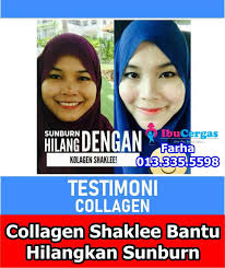 Ini mungkin kerana anda belum bertemu dengan cara hilangkan parut hitam di muka yang betul. Cara Menghilangkan Sunburn Cara Hilangkan Sunburn Testimoni Shaklee Hilangkan Sunburn Hilangkan Sunburn Dengan Cepat Merawat Kulit Kolagen Kulit Orang
