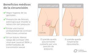 Circuncision Es Recomendable En Ninos Clinica Las Condes