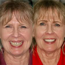 Moses Lake Family Dentistry