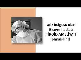Goz Bulgusu Olan Graves Hastasi Tiroid Ameliyati Olmalidir Youtube