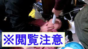 衝撃映像】喉に詰まったモチを掃除機で吸い出し救出する瞬間 - YouTube