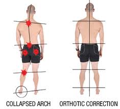 Security Check Required Runners Knee Shin Splints Orthotics