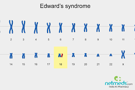 Reye's syndrome, acute hepatic encephalopathy, salicylic acid derivatives, children. Edward S Syndrome Causes Symptoms And Treatment