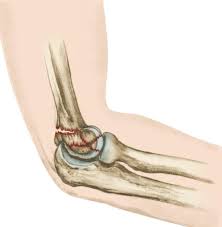 There are two joints that make up the the large muscle in the back of the arm, the triceps, attaches to the point of the ulna (called the elbow examination script. Distal Humerus Fractures Of The Elbow Orthoinfo Aaos