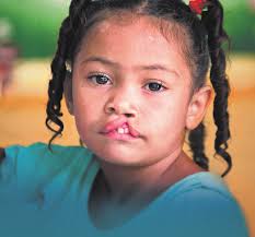 THE IMPACT OF CANADIAN PHILANTHROPY CANADIANS ARE CHANGING THEIR  VOLUNTEERING AND GIVING BEHAVIOUR