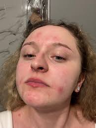 Anyone using Cerave? What do you use, the lotion or the cream?